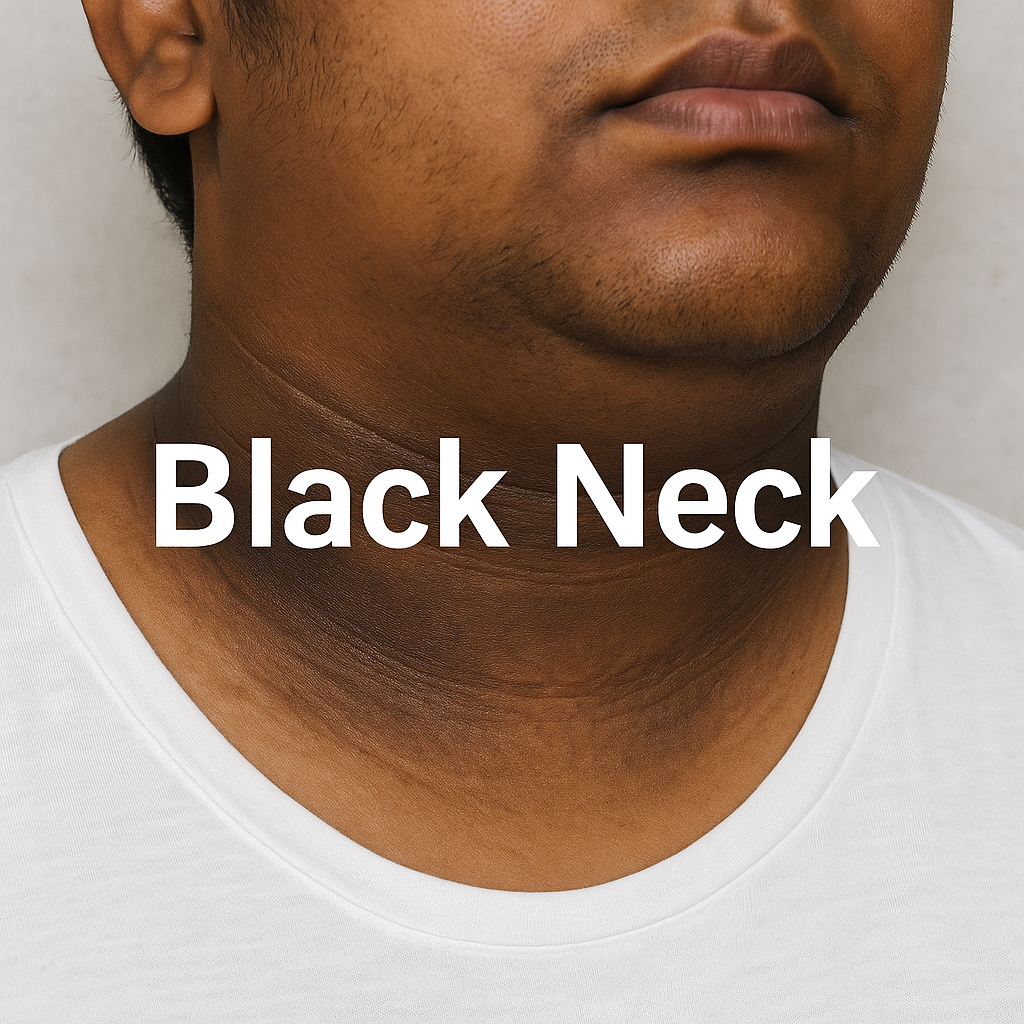 Black Neck During Summer Causes Remedies