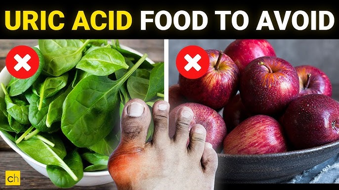 best food for Uric Acid.