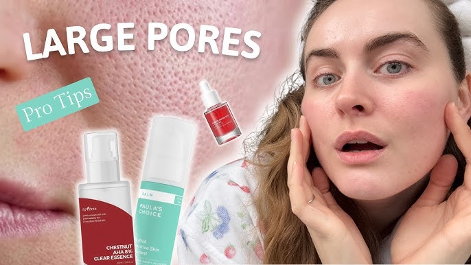 Here’s an SEO-friendly alt text with your focus keyword: **"Best facewash for oily skin to control excess oil, prevent acne, and keep skin fresh and clear"**